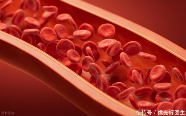 易宝配资 中老年人不想中风，除了远离烟酒，还要管住这3个习惯